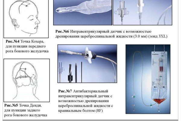 Kraken ссылка krakentor site